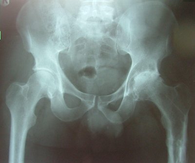 Orthopaedic Trauma Hip Knee Consultant Surgeon