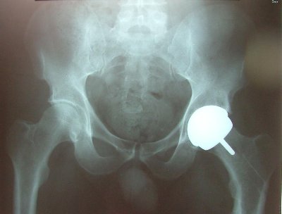 Orthopaedic Trauma Hip Knee Consultant Surgeon