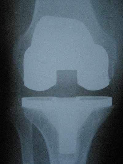 Orthopaedic Trauma Hip Knee Consultant Surgeon